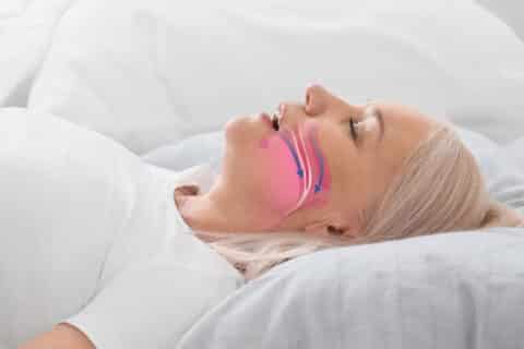 Sleep Apnea Dentistry